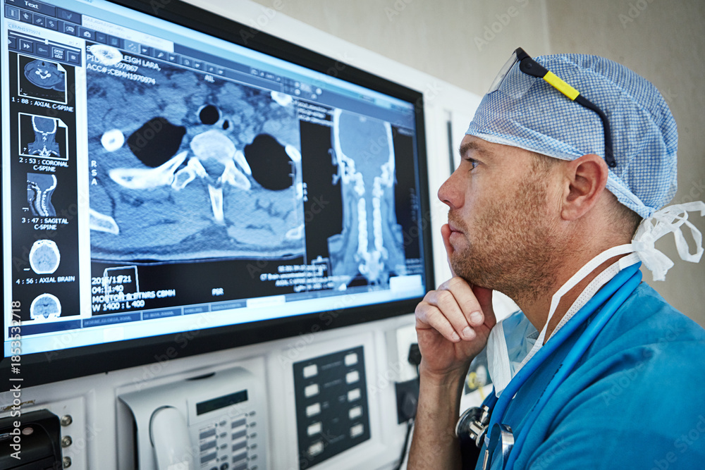 Ταπετσαρία Surgeon, man or thinking with scan in theater for surgery planning, tumor progress or assessment