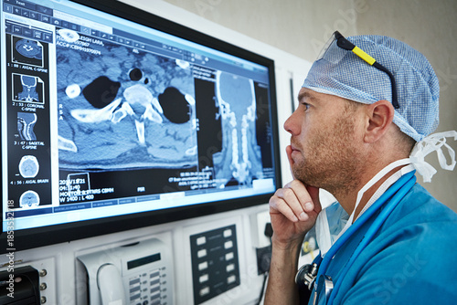 Billede på lærred Surgeon, man or thinking with scan in theater for surgery planning, tumor progress or assessment