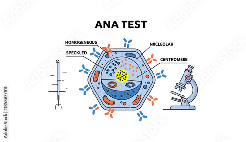 ANA Test Antinuclear Antibody Patterns Infographic