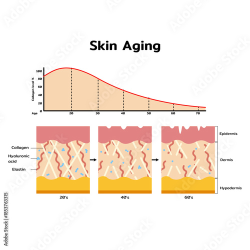 Skin Aging Process Infographic Illustration