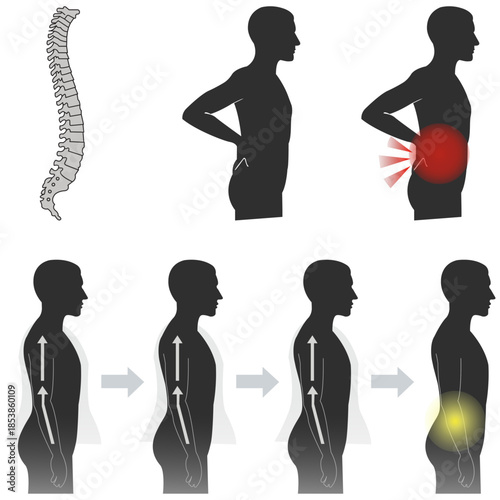 Human Spine Illustration A detailed diagram showcasing the human spine's anatomy, posture, and potential issues, providing insights into musculoskeletal health.