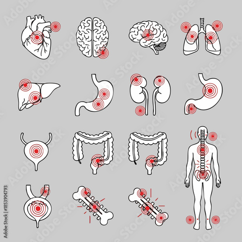 This illustration depicts various human internal organs and skeletal parts experiencing pain or inflammation, highlighting common medical conditions and discomfort within the body.