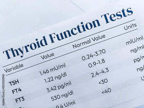 Fotografie Thyroid function Test report top view medical background.
