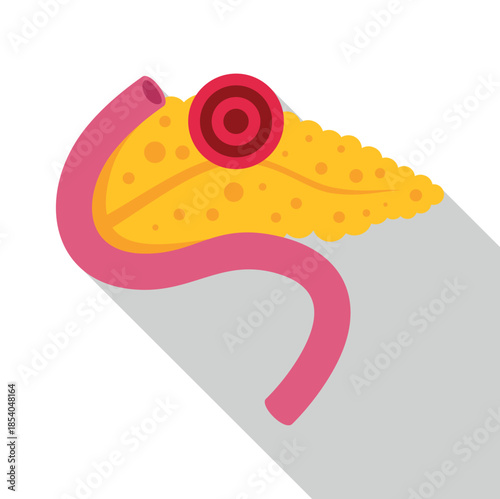 Human pancreas internal organ showing a disease or tumor
