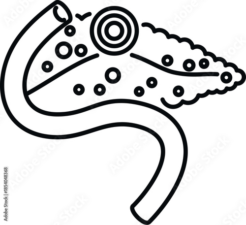 Human pancreas medical illustration showing inflammation symptoms