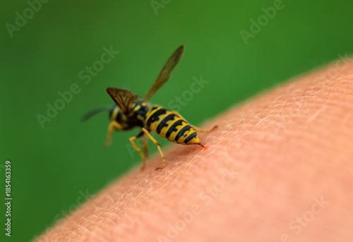 close-up of a striped dangerous insect wasp stings a person in the skin of hi...