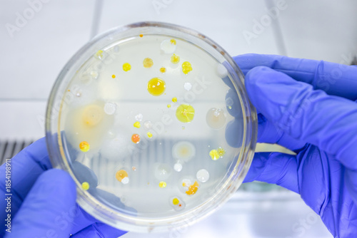 A petri dish with a transparent nutrient medium for isolating bacteria from human skin, the petri dish is illuminated by light from below.
