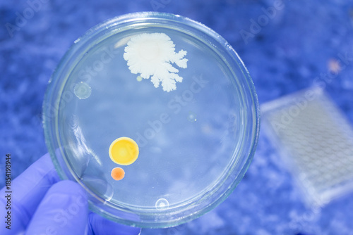 Different bacterial colonies on one petri dish.