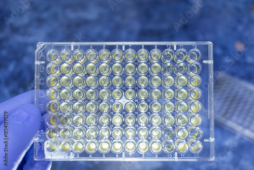 96-well plate with wells filled with bacterial cell culture.