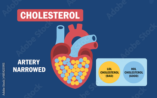 Cholesterol Impact on Heart Health
