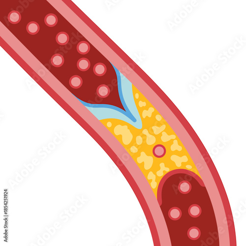 Blood Vessel Cross Section Illustration