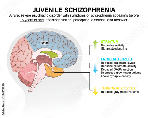 Juvenile Schizophrenia: Effect on brain
