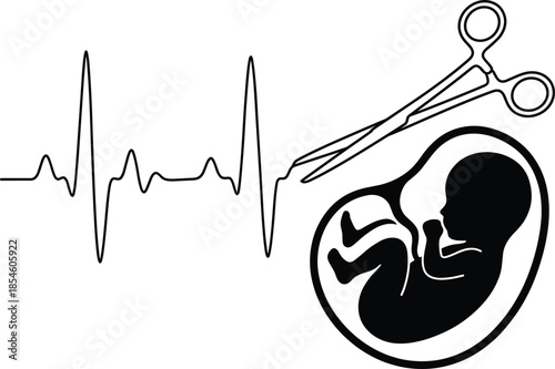Vector silhouette of a fetus in the womb with a heartbeat monitor line and surgical scissors isolated on a white background