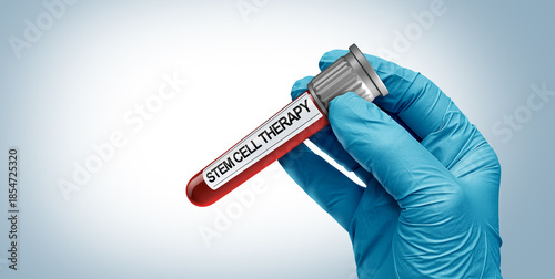 Stem Cell Donation and human regenerative treatment donating stem cells as Regenerative Medicine as Mesenchymal Cells in a test tube as a Doctor or researcher holding a glass container for joint pain.