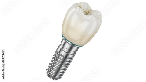 Dental implant PNG isolated on transparent background, artificial tooth for stomatology and prosthetics, screw-type implant
