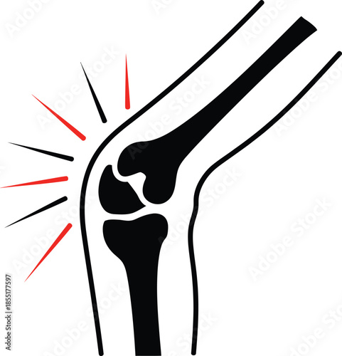 Vector illustration of a bent human knee joint with red pain lines, ideal for medical, anatomical, or orthopedic design use.