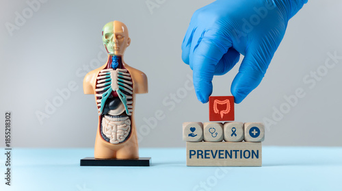 Colorectal cancer prevention, early detection, gastrointestinal care, and intestinal polyp management. A doctor's hand arranges wooden cubes with a colon icon next to an anatomical model.