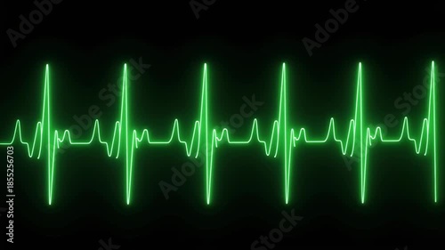 Heartbeat Line Monitor ECG - Pulse Rhythm Overlay