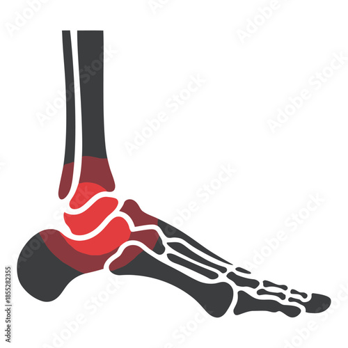 A diagram highlights the bones and joints of the human foot and ankle with areas of pain shown in red.