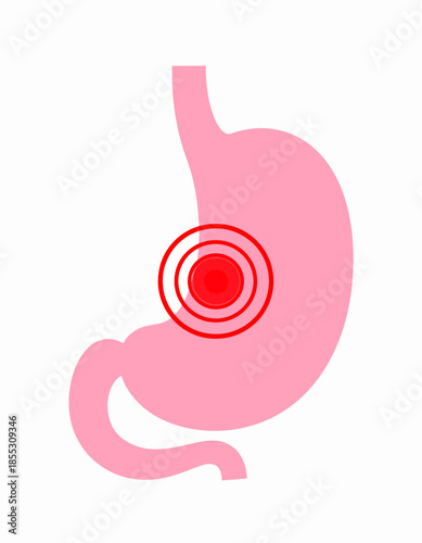 Stomach Pain and Discomfort Illustrated with Red Circles Indicating Ailment