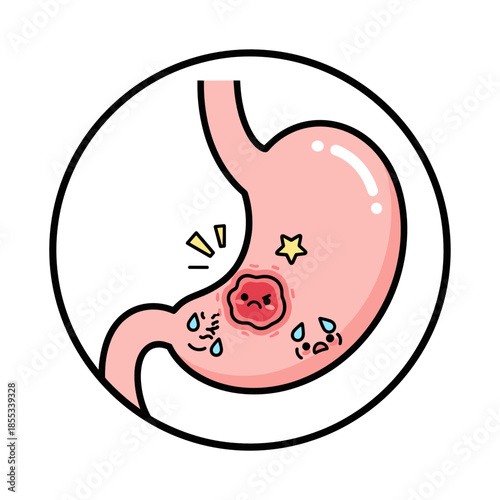 Stomach ulcer illustration showing pain and discomfort in anatomy  