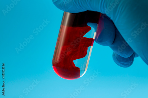 Blood Sample Testing Concept with Gloved Hand Holding Test Tube of Red Liquid on Blue Background