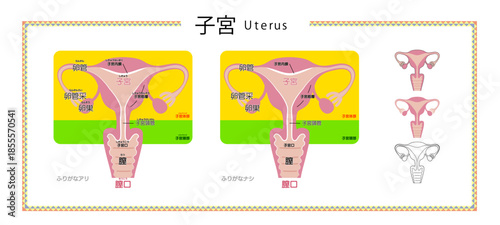 女性生殖器（子宮・卵巣・卵管）の図解イラスト｜医学用語のふりがな有無・小アイコン付き