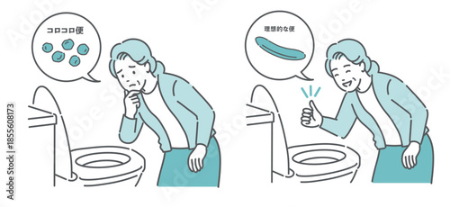 便の状態比較イラスト（高齢女性・コロコロ便NG vs 理想的な便OK・便秘改善）