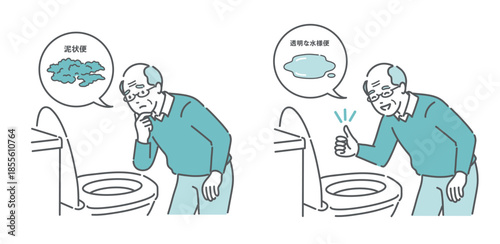 大腸カメラ前処置の便の状態比較イラスト（高齢男性・泥状便NG・透明な水様便OK）