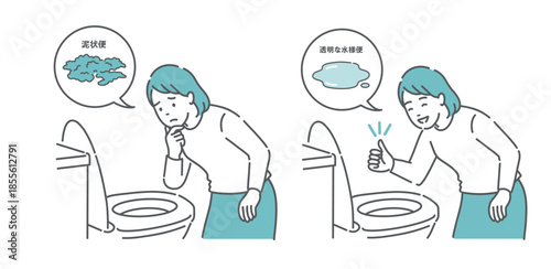 大腸カメラ前処置の便の状態比較イラスト（女性・泥状便NG・透明な水様便OK）