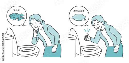 大腸カメラ前処置の便の状態比較イラスト（高齢女性・泥状便NG・透明な水様便OK）