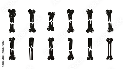 A collection of stylized black bones showing various types of fractures and breaks, illustrating different forms of bone damage.