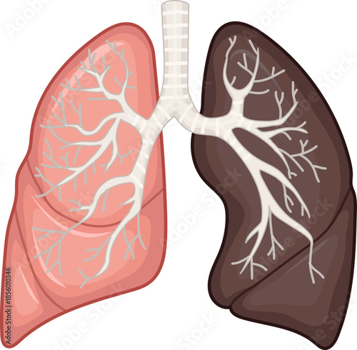 Illustration of Healthy and Smoker Lungs, Human Lungs Anatomy
