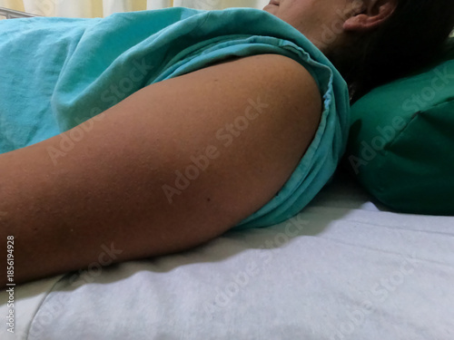 BRAZO DESCUBIERTO DE PACIENTE MUJER CON BATA AZUL