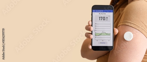 Fotografia Woman with glucose sensor using mobile phone for measuring blood sugar level on