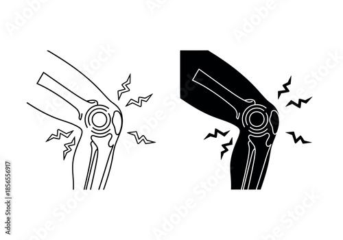 Illustration depicting knee pain with radiating discomfort showcasing skeletal and shaded anatomical representations high-quality professional