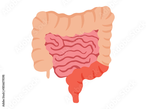 Colitis Disease in Intestines or Intestinal Colon 
