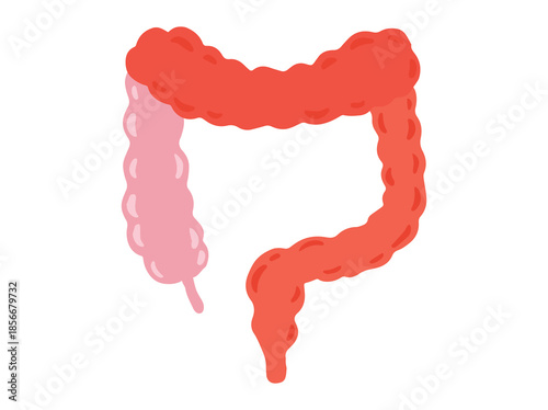 Colitis Disease in Intestines Clip Art
