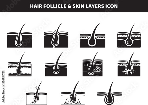 Detailed illustration showcasing various cross sections of hair follicles and skin layers depicting different stages and conditions visually high-quality