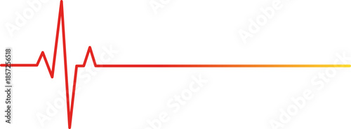 Electrocardiogram signal