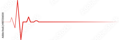 Graph displaying heartbeat signal