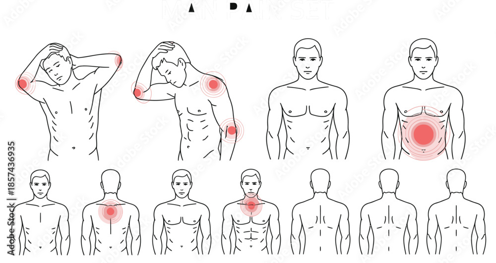 Fototapeta premium Detailed set of illustrations showing various pain symptoms and discomfort zones on a mans body