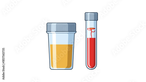 Vector illustration of medical analysis with a urine sample in a sterile cup and a blood sample in a vacuum test tube.