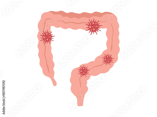 infection Disease in Intestines Clip Art
