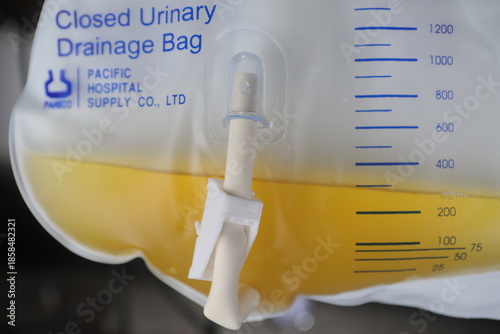 Taipei, Taiwan - December 27th 2025 - Closed urinary drainage bag with yellow fluid.
