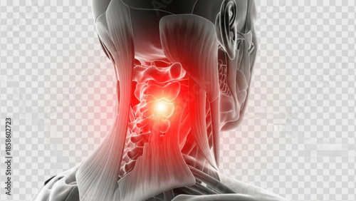 A medical illustration of a human neck with a highlighted spine and glowing red pain point on the cervical vertebrae area
