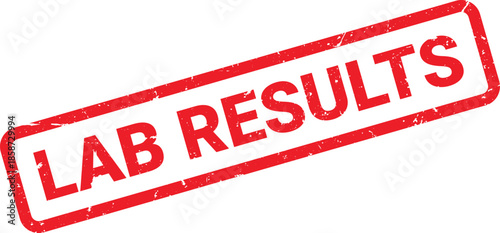 Distressed Red Lab Results Stamp on White Background, Medical Test Outcome Indicator