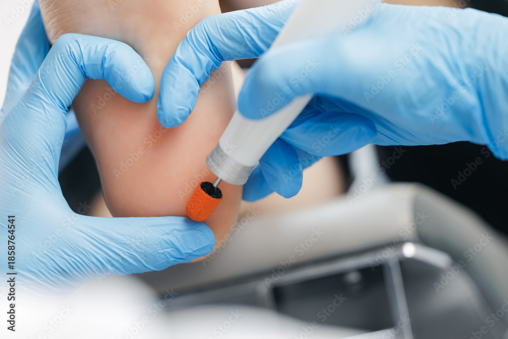 Obraz premium Professional foot treatment by podiatrist using specialized tool, heart symbol