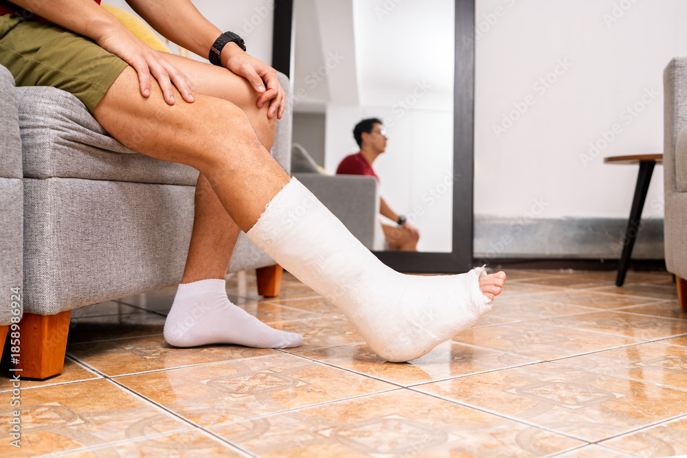 Obraz premium Man recovering from injury with leg cast at home