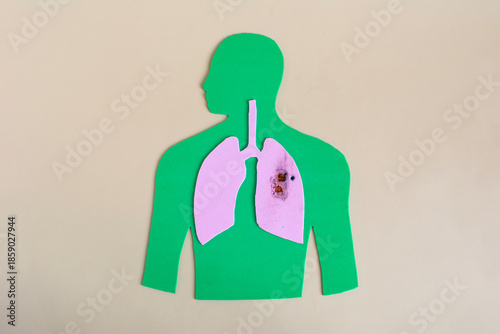 Silhouette of a man with diseased lungs, highlighted in close-up. The concept of the harm of smoking and smoking-related diseases